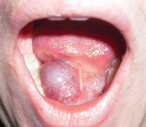 Read more about the article Never Underestimate The Influence Of Oral Mucocele Surgery.